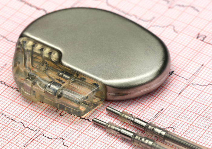 Pacemaker on a table on top of a patient EKG report received from remote patient monitoring device